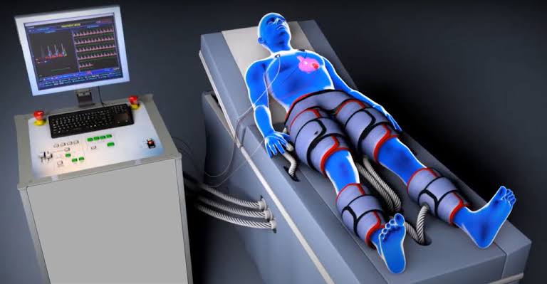 Enhanced External Counter Pulsation Therapy